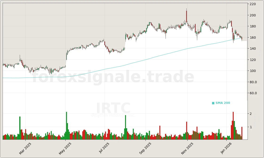 Trading Signale 323 IRTC Chart