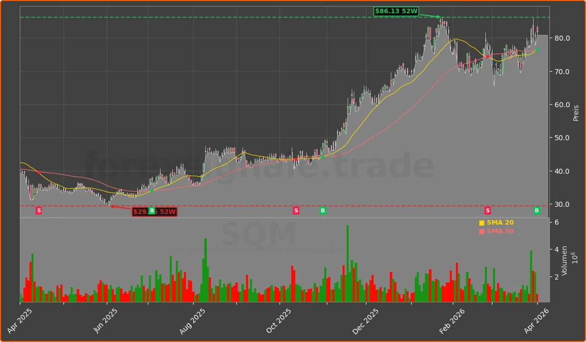 SQM Chart