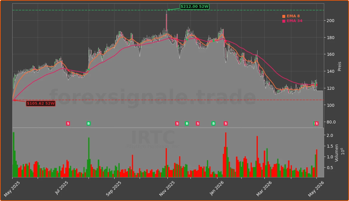 IRTC Chart