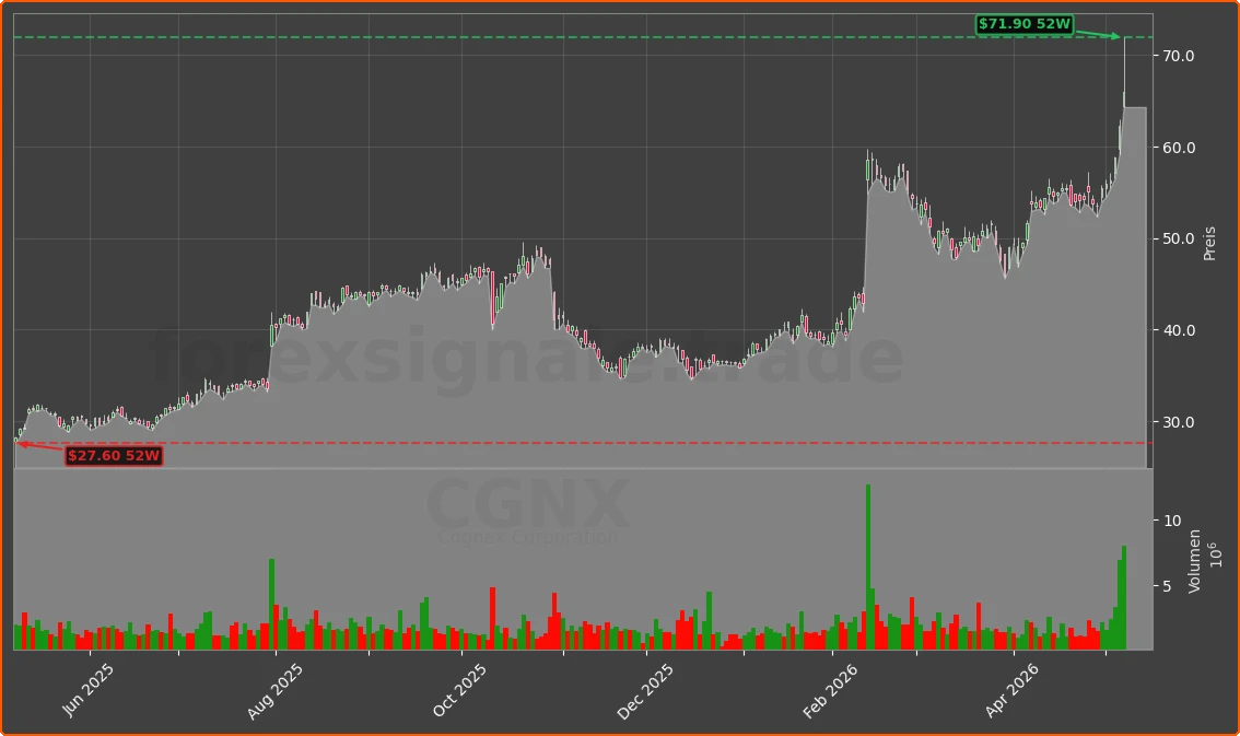CGNX Chart
