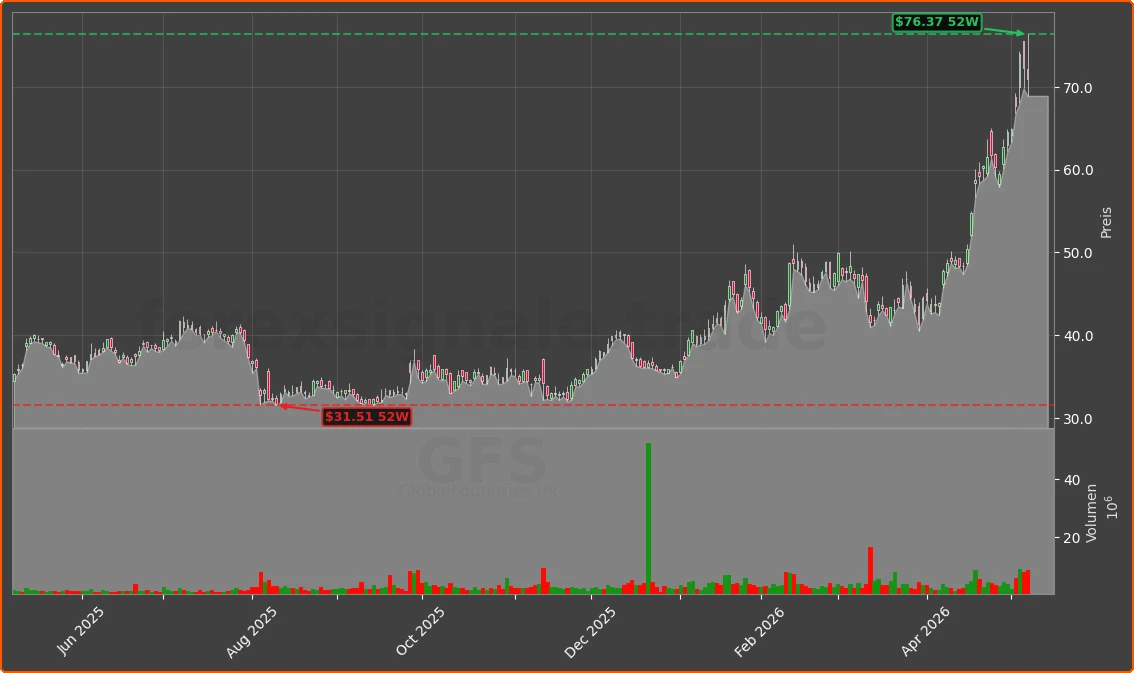 GFS Chart