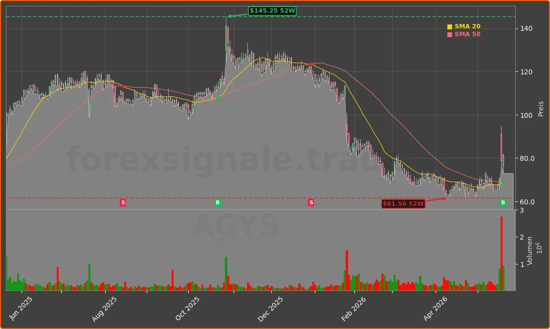 AGYS Chart