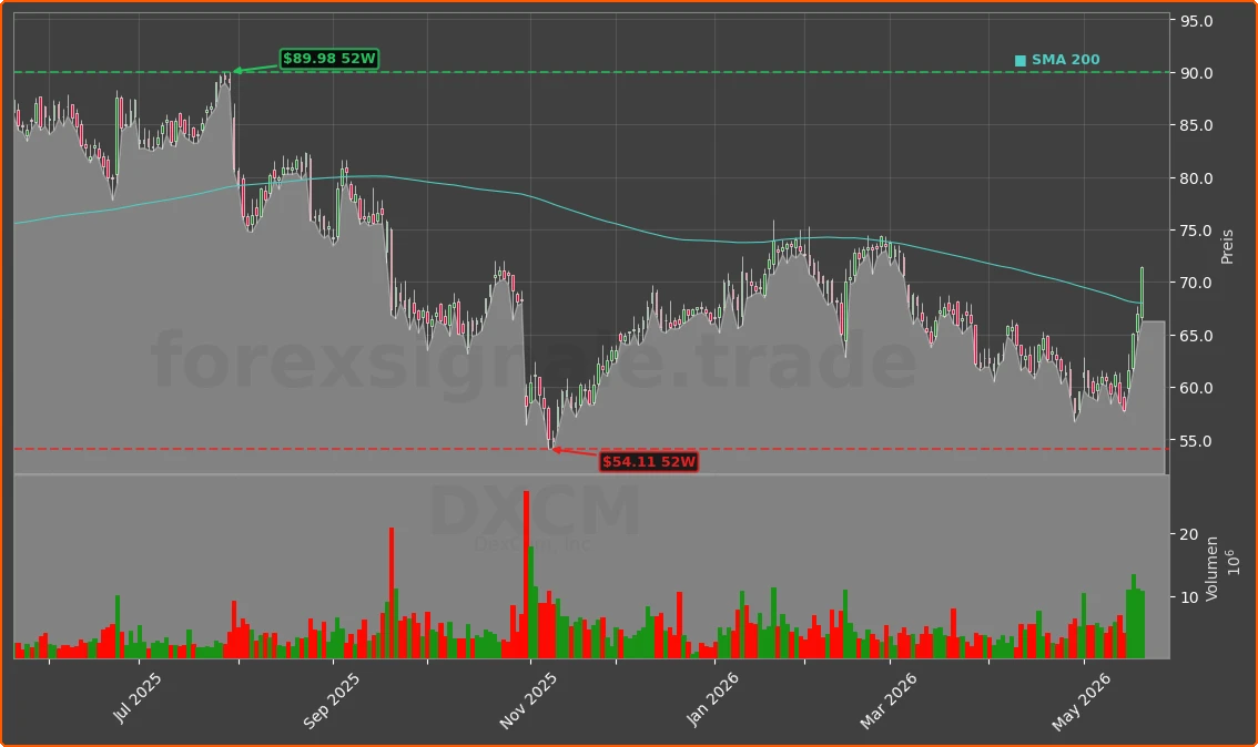 DXCM Chart