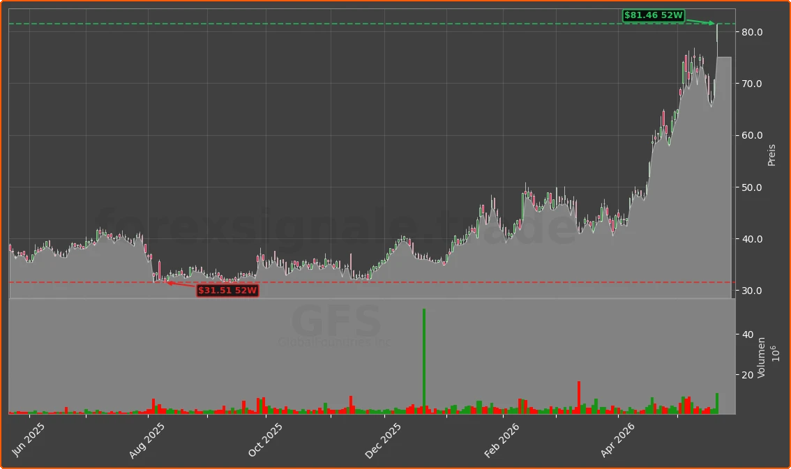 GFS Chart