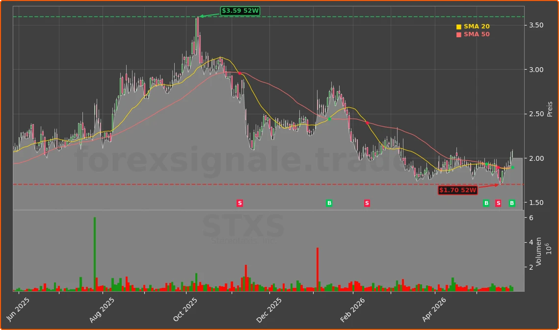 STXS Chart