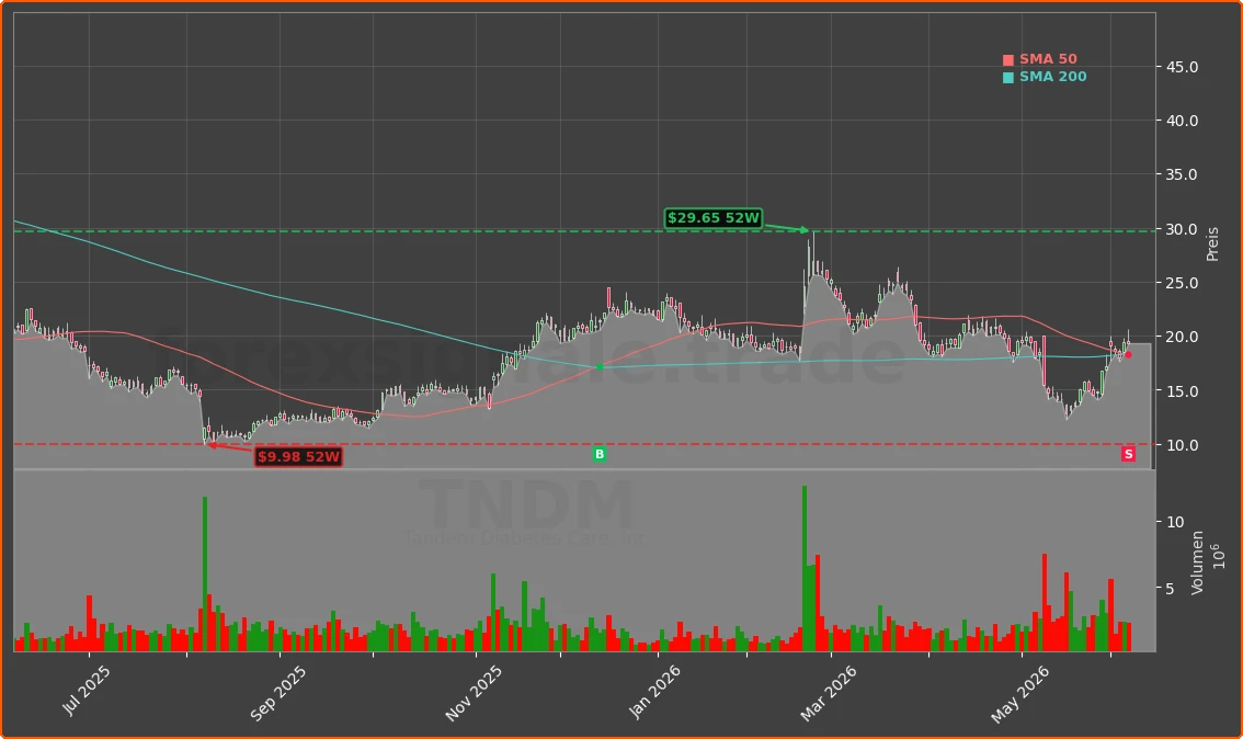 TNDM Chart