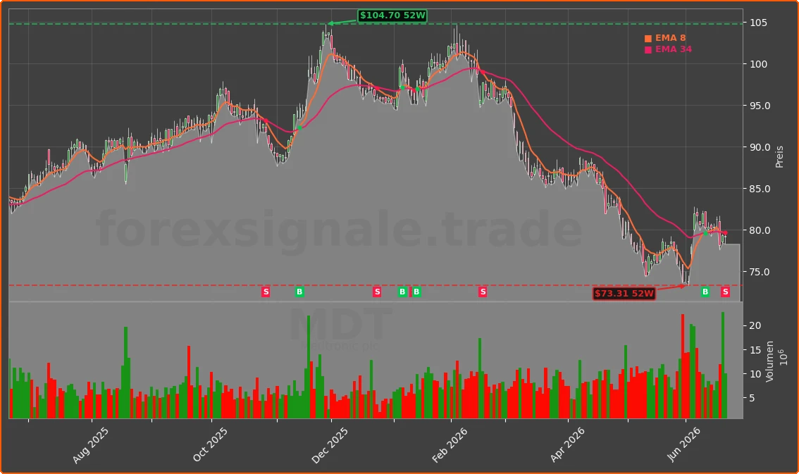 MDT Chart